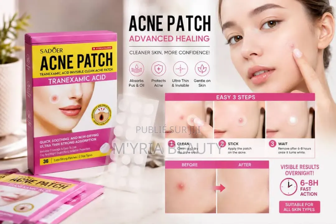 Ance Patch