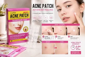 Ance Patch