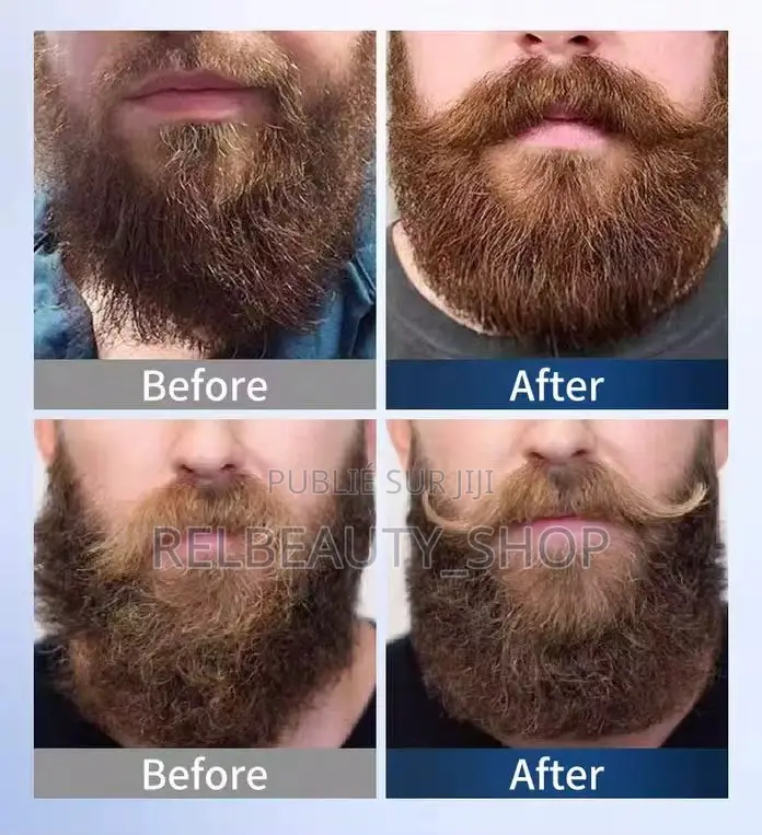Kit 4 Pièces Pour Croissance Et Soins De Barbe