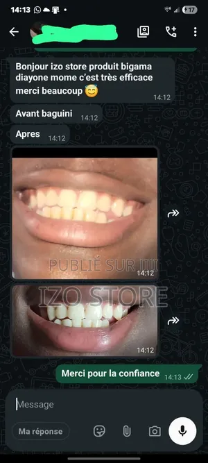 GlorySmile V34