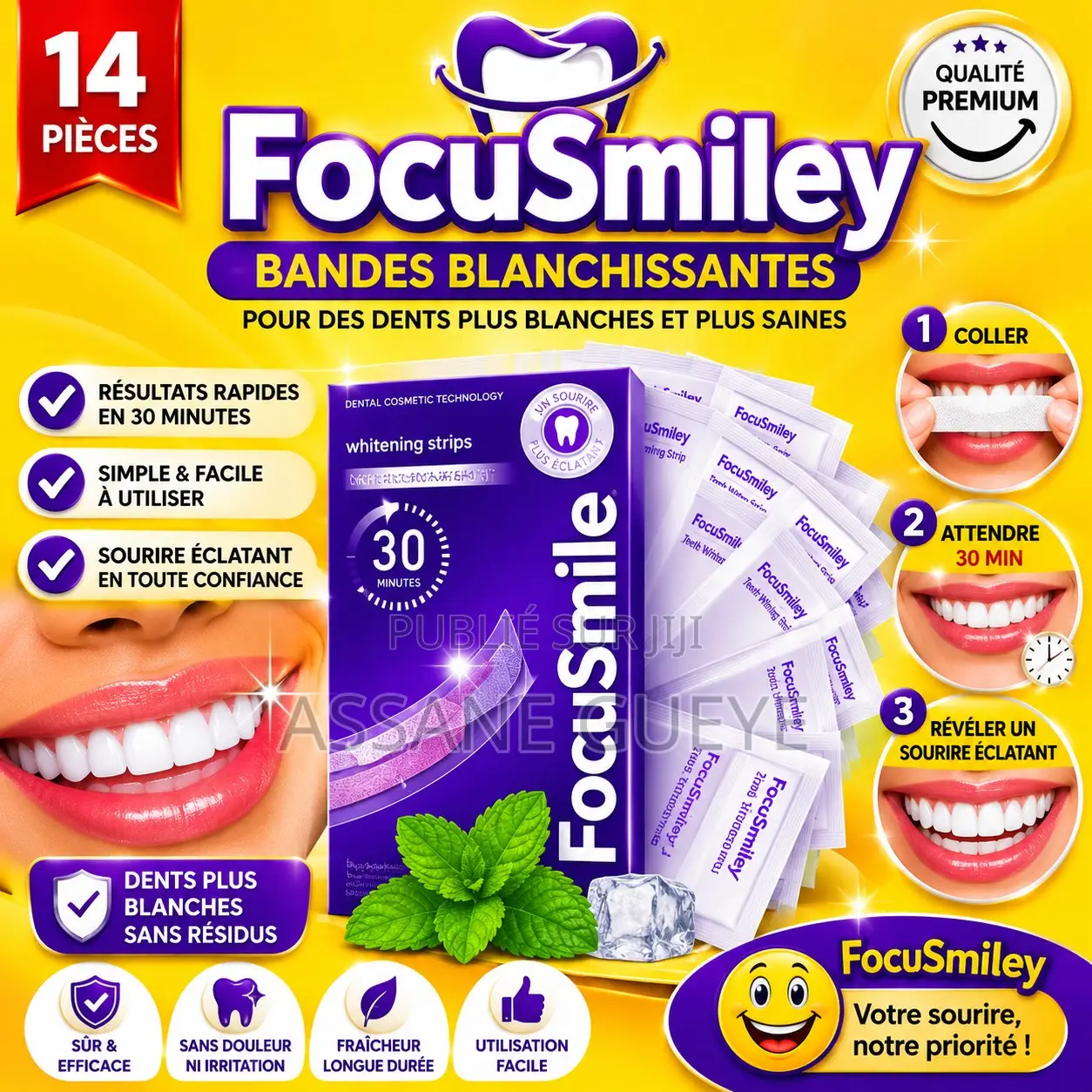 SMILE KIT — BANDES BLANCHISSANTES Nouveau ! Sourire Éclatant Band
