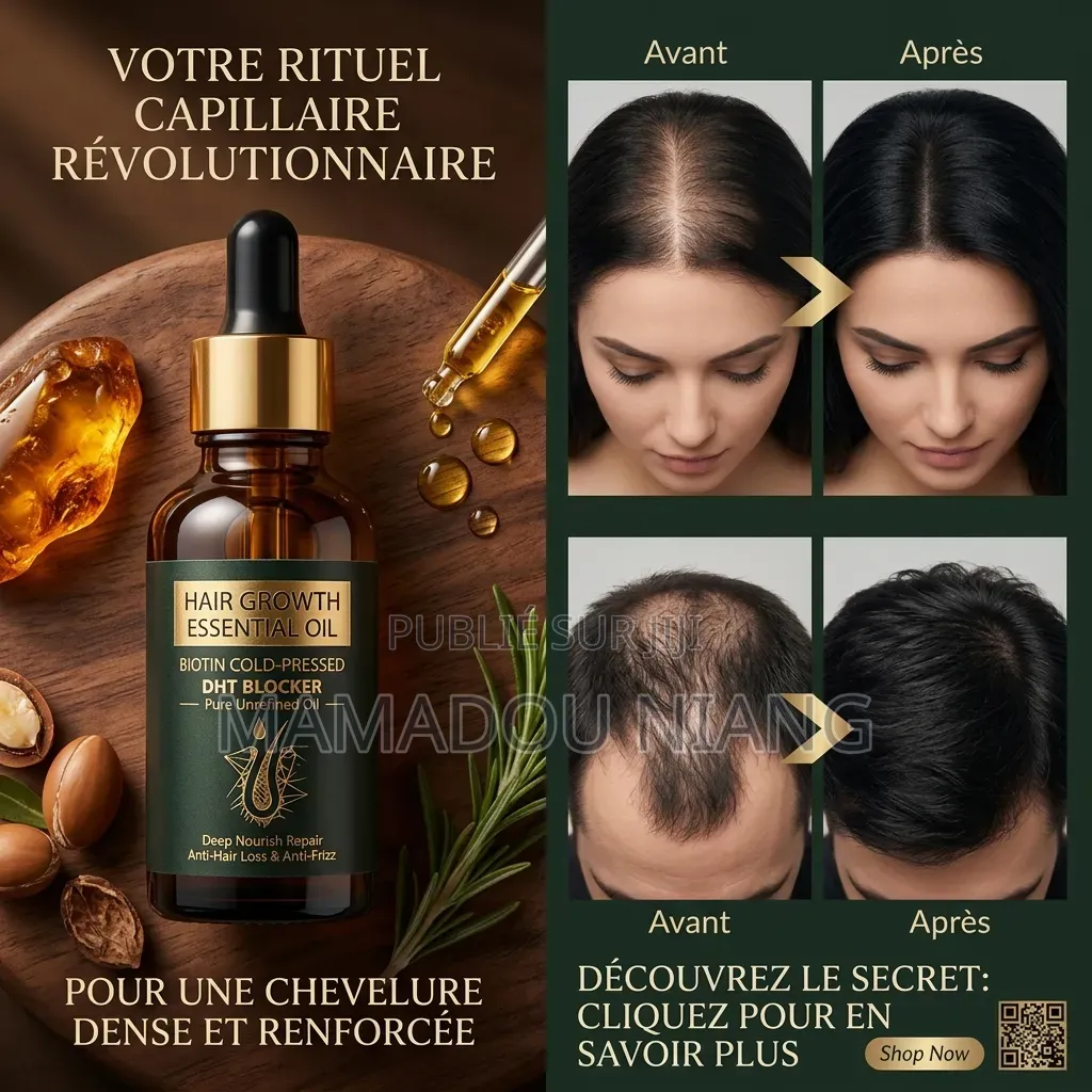 Kit De Croissance Capillaire, Anti Chute Et Nourrisse La Cuir Chevelur