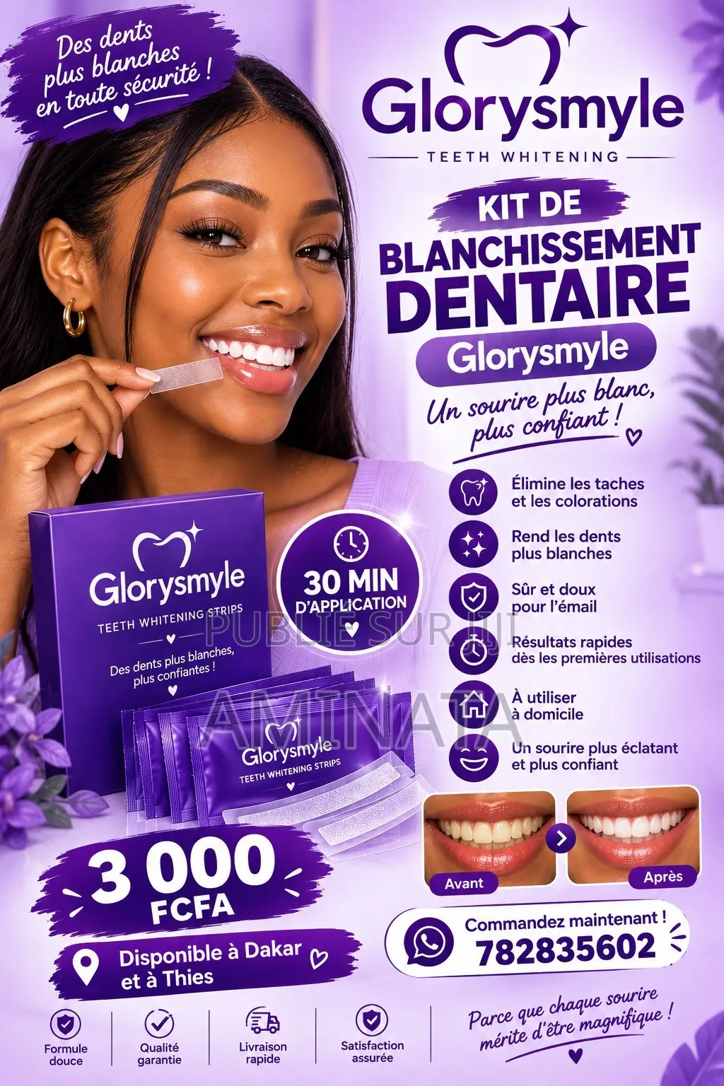 Blanchissement Dentaire