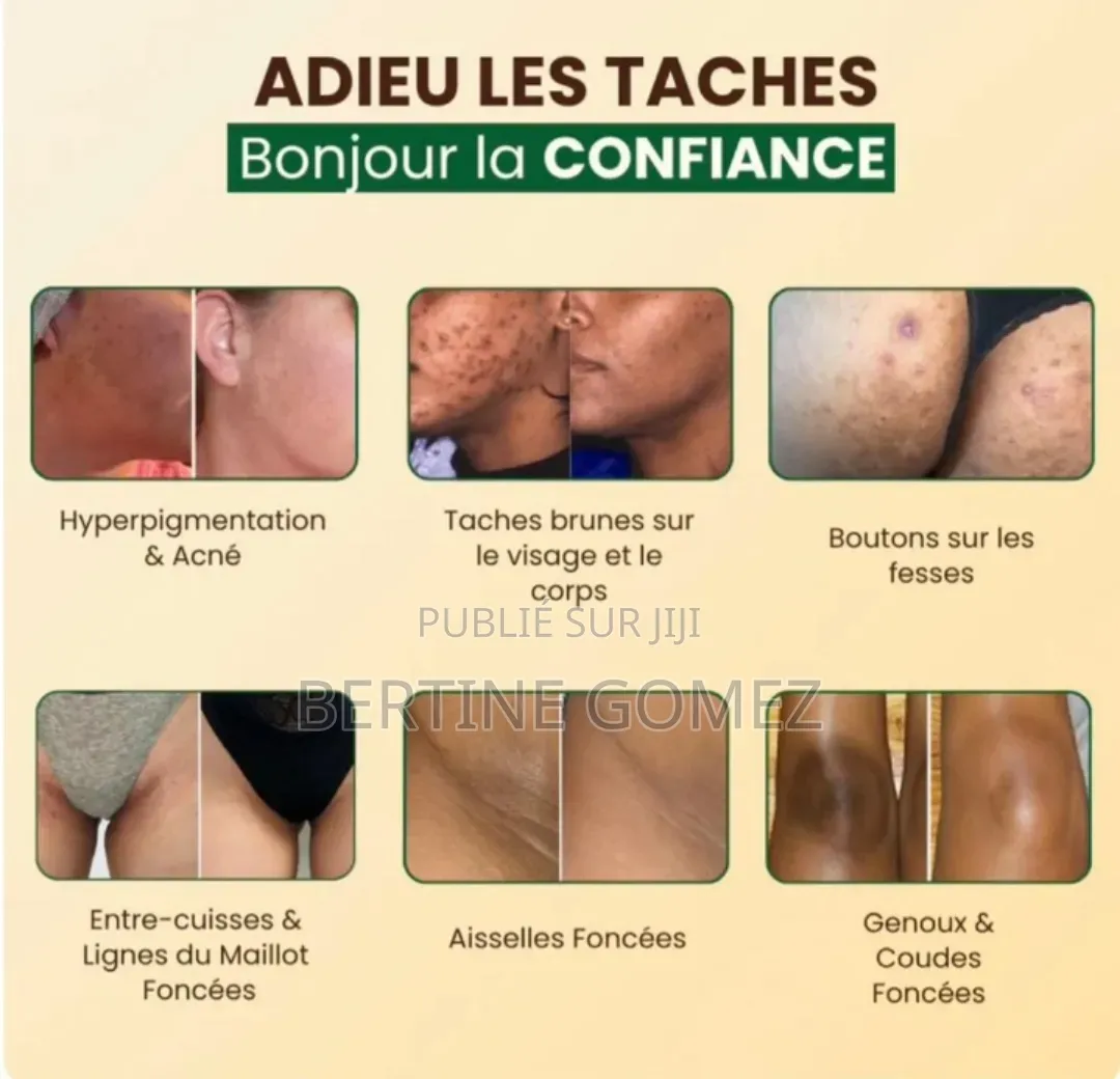 Savon Curcuma & Acide Kojique