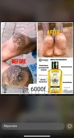 Huile De Serpent Longrich