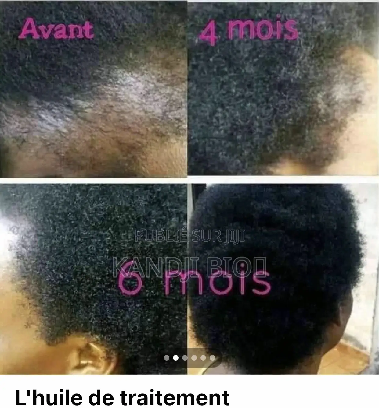 Dérmatol Pour Cheuveux