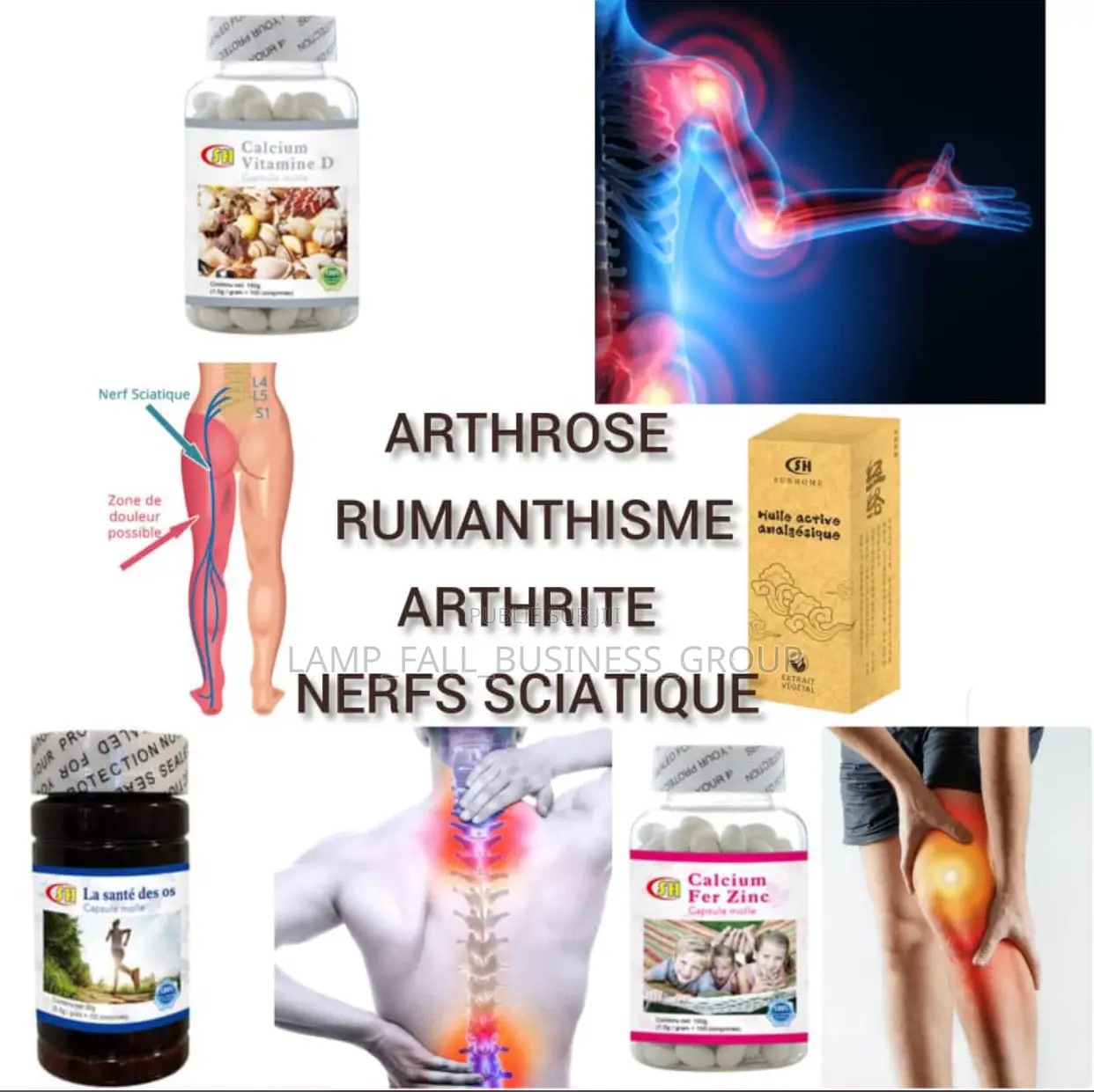 Traitement Arthrose/Nerfs Sciatique