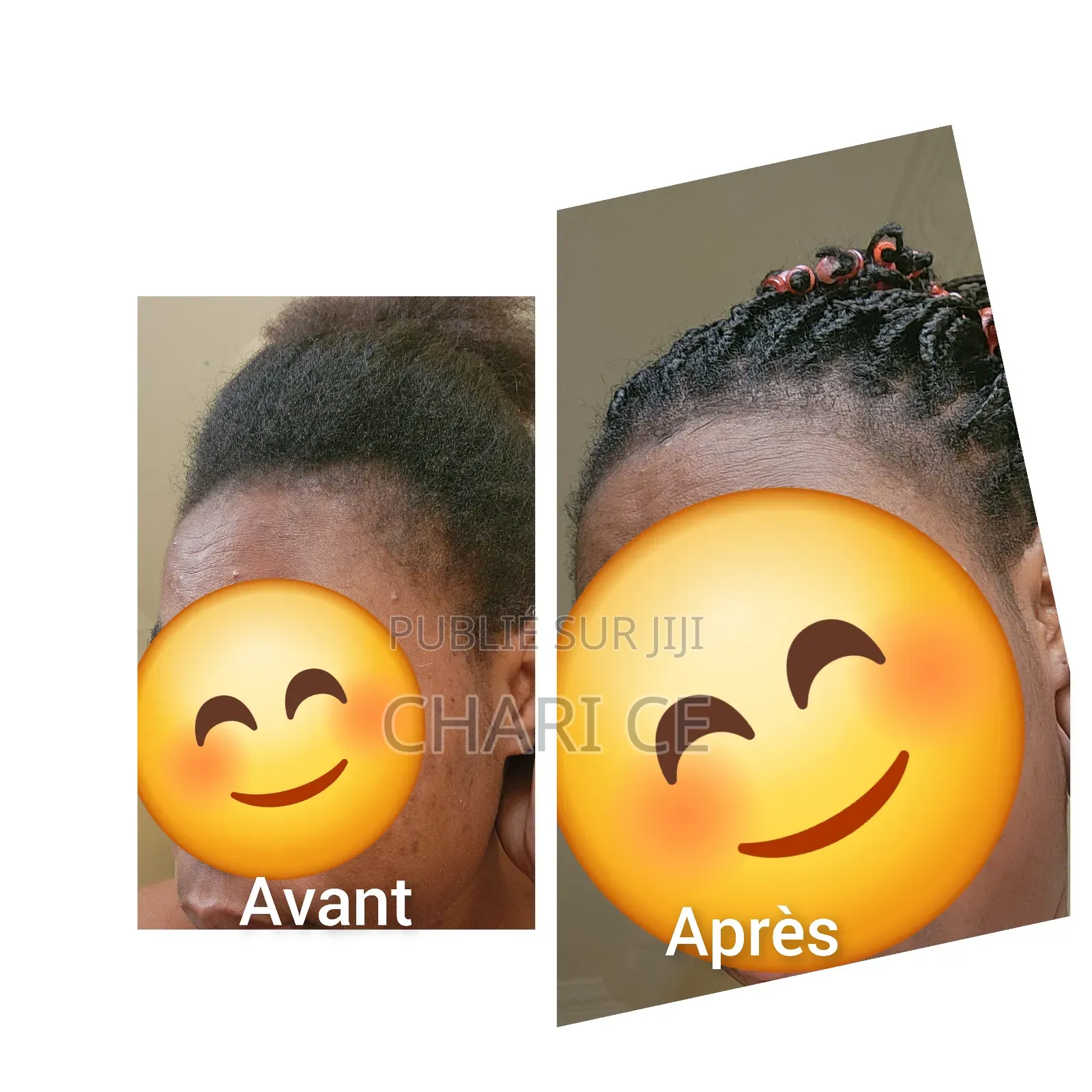 Crème Capillaire Et Sérum Pour La Pousse Des Cheveux