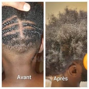 Crème Capillaire Et Sérum Pour La Pousse Des Cheveux