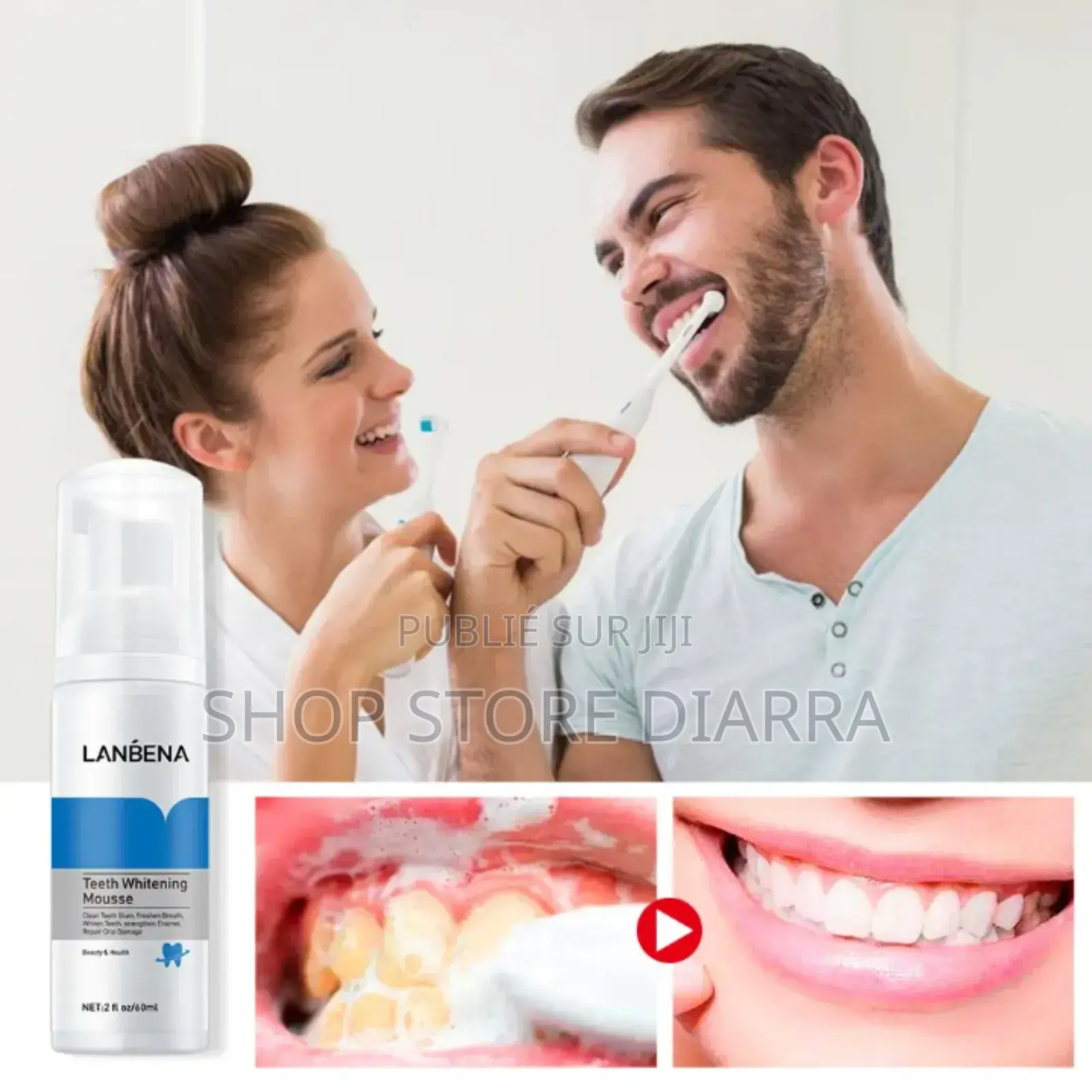 Blanchiment Dentaire Bio – Un Sourire Plus Blanc