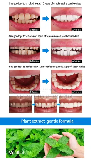 Blanchiment Dentaire Bio – Un Sourire Plus Blanc