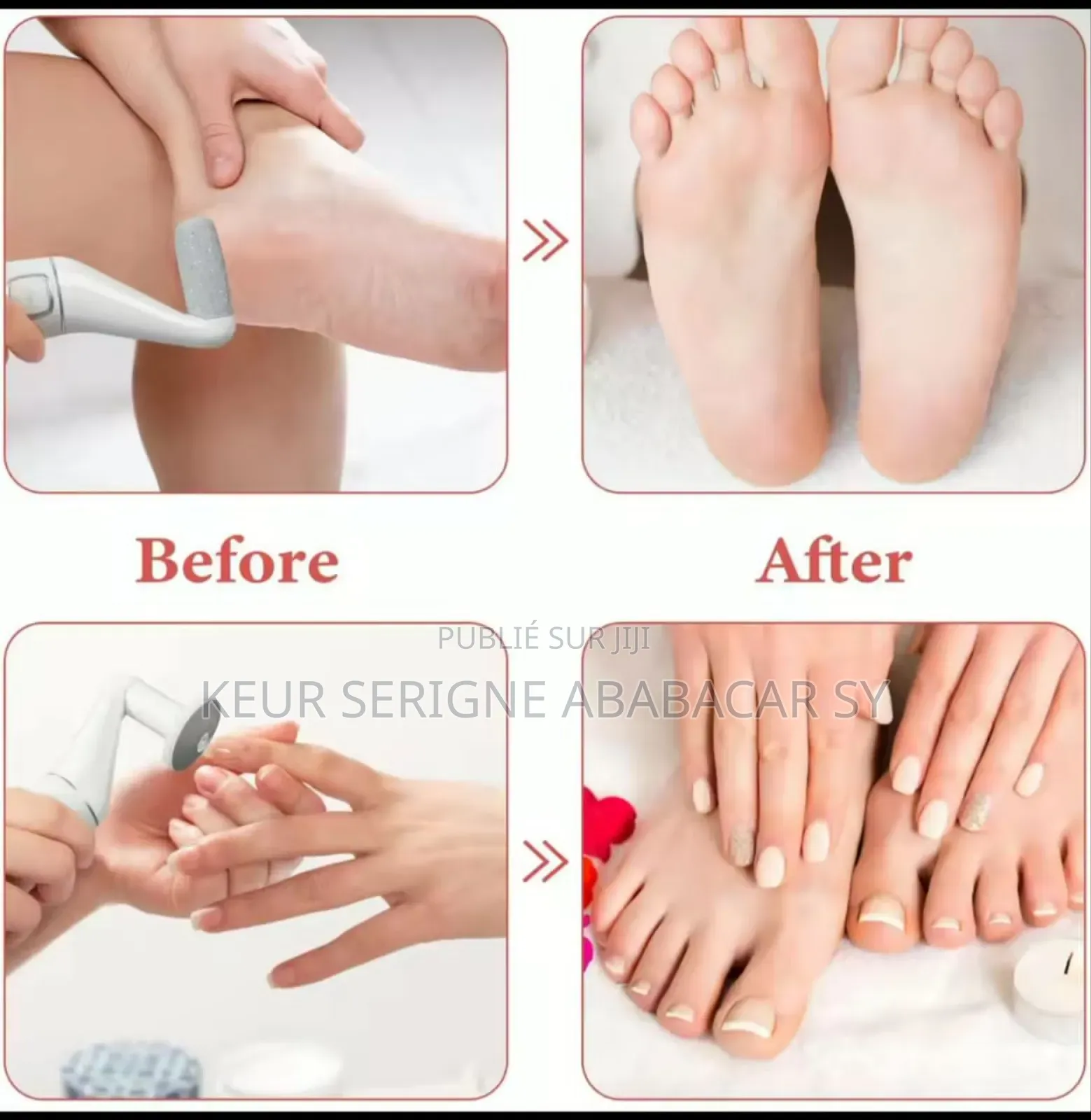 Appareil Électrique Pédicure Pour Pied