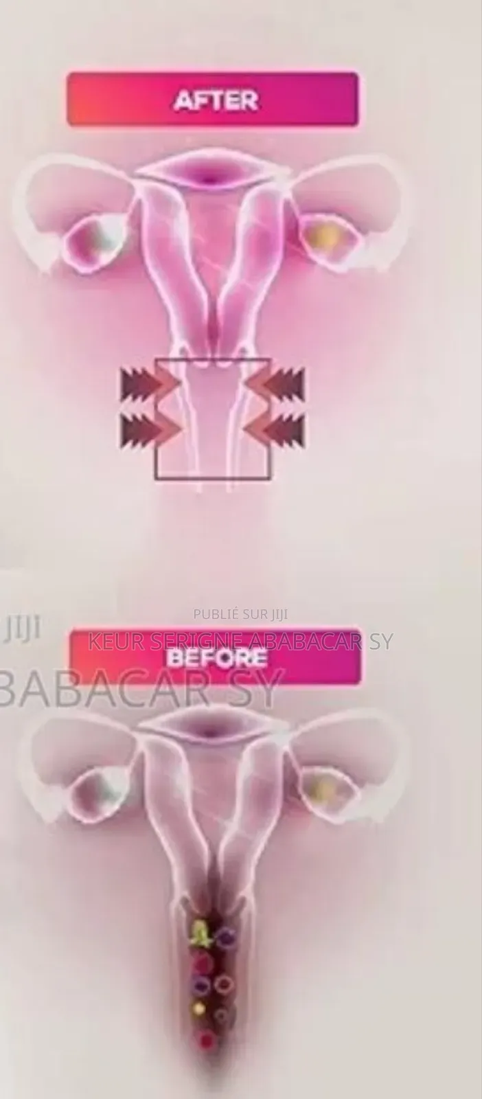 Perle De Yonni Pour Sante Et Hygiène Intimes