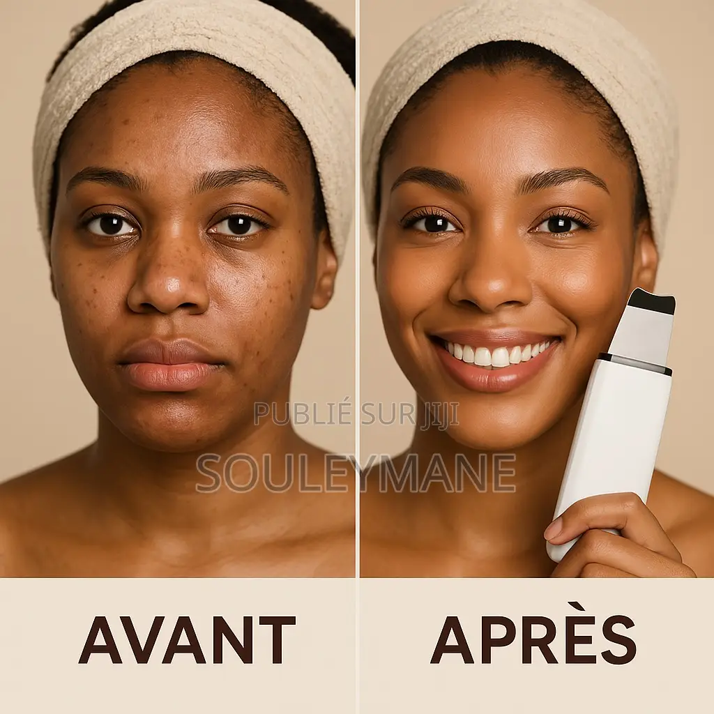Epurateur De Peau À Ultrasons