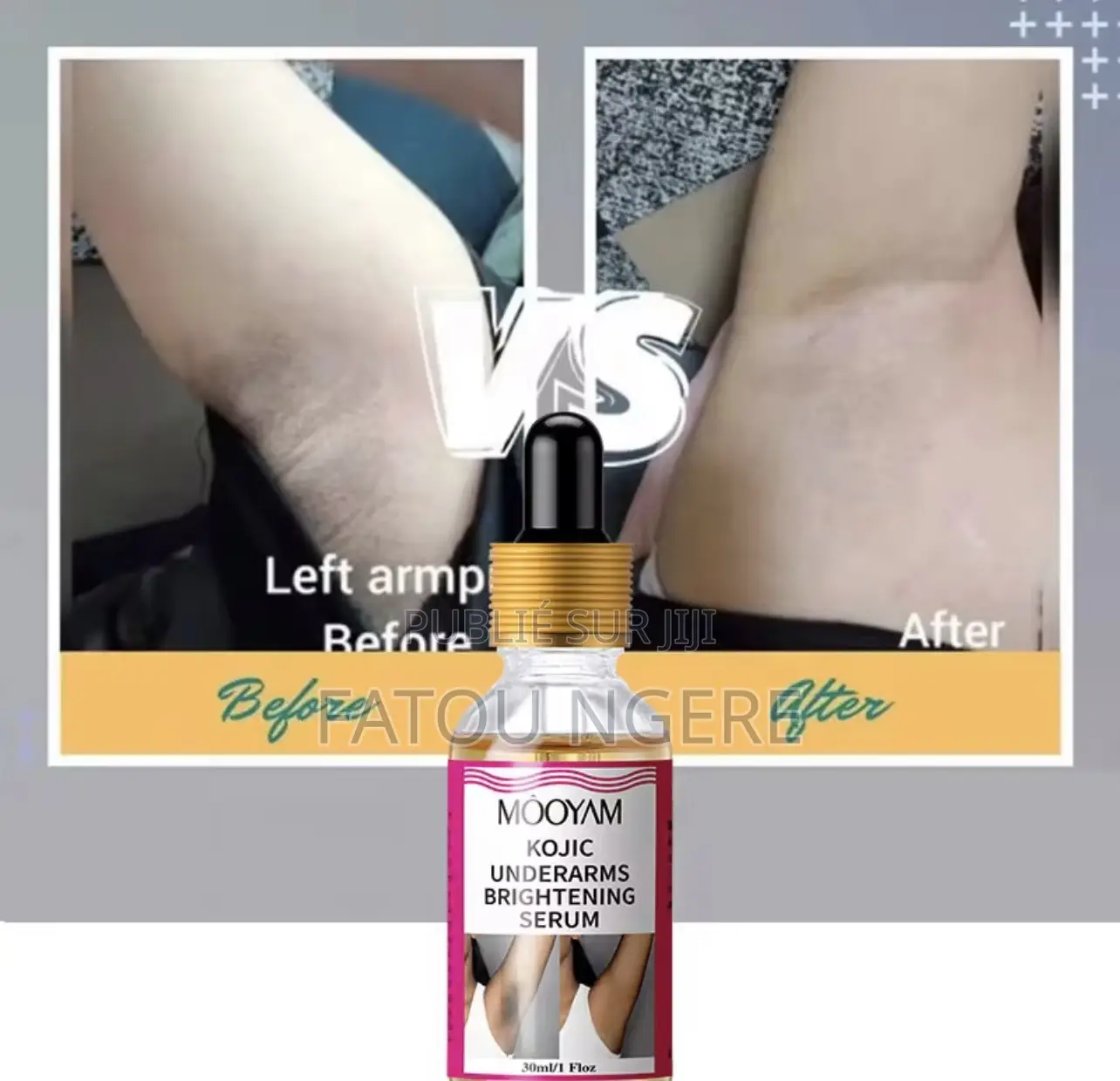 Sérum Blanchissant Des Zones Sombres