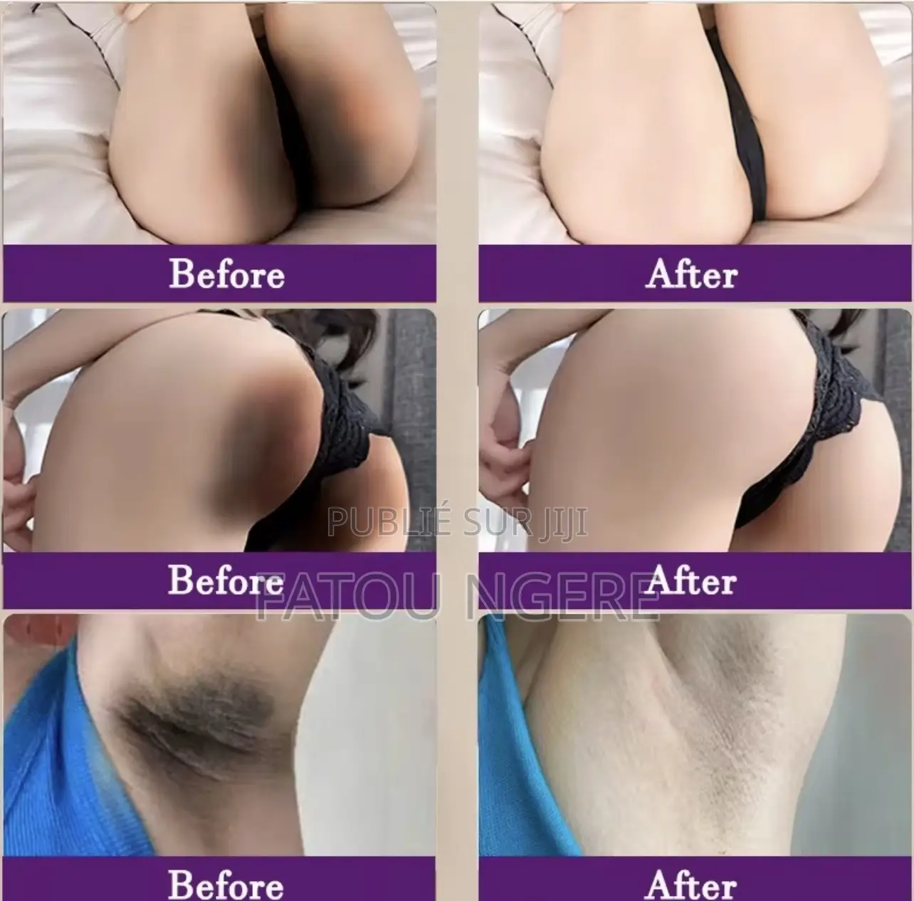 Sérum Blanchissant Des Zones Sombres