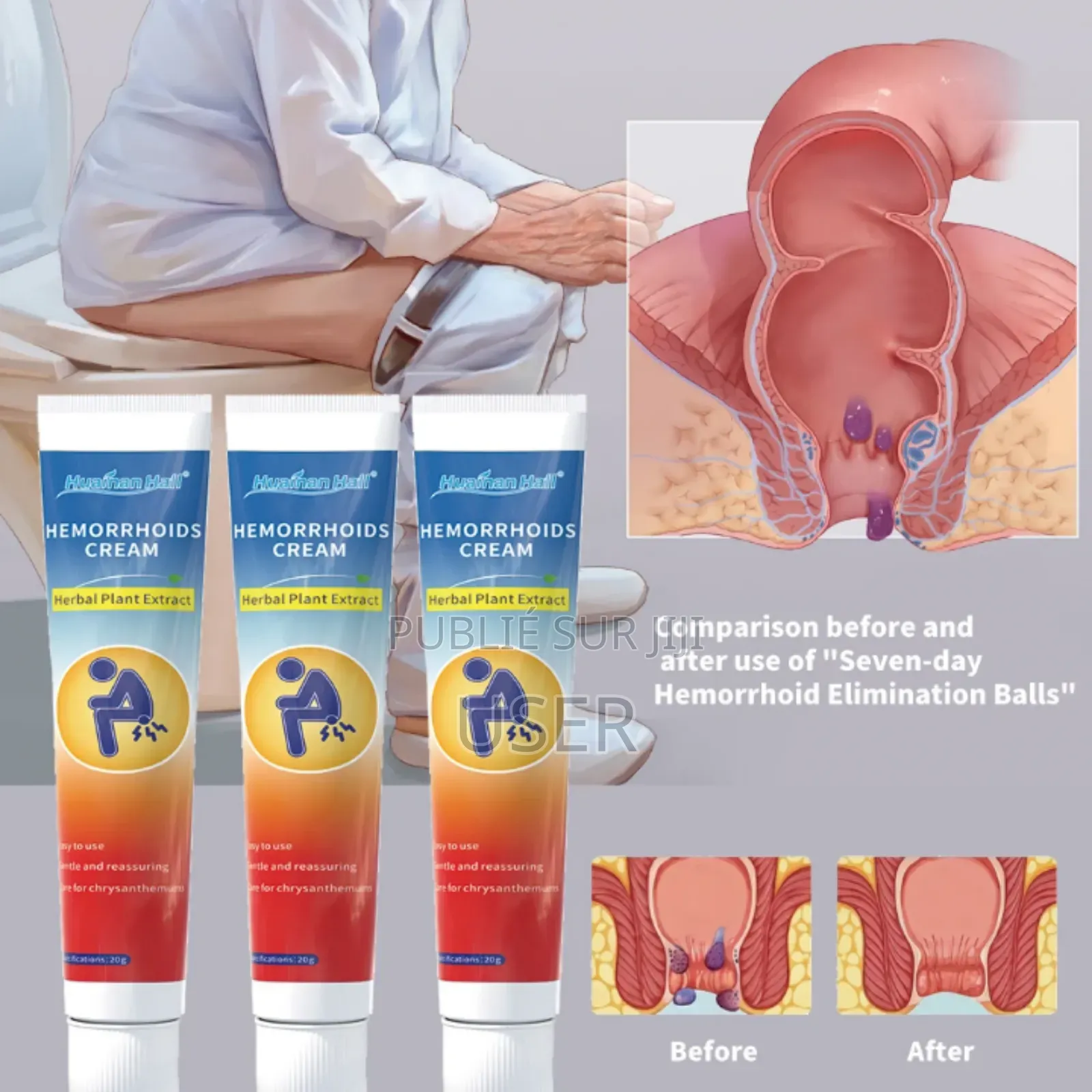 Créme Hemmoride
