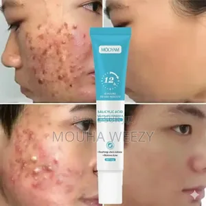 Photo - Anti Acné, Anti Tâch Noir Résultat 3 Jours Seulement