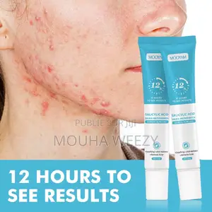 Photo - Mooyam Rapide Et Efficace Pour Les Acnés