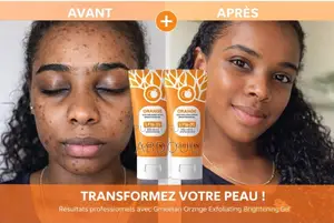 Gel Exfoliant a Base Dorange