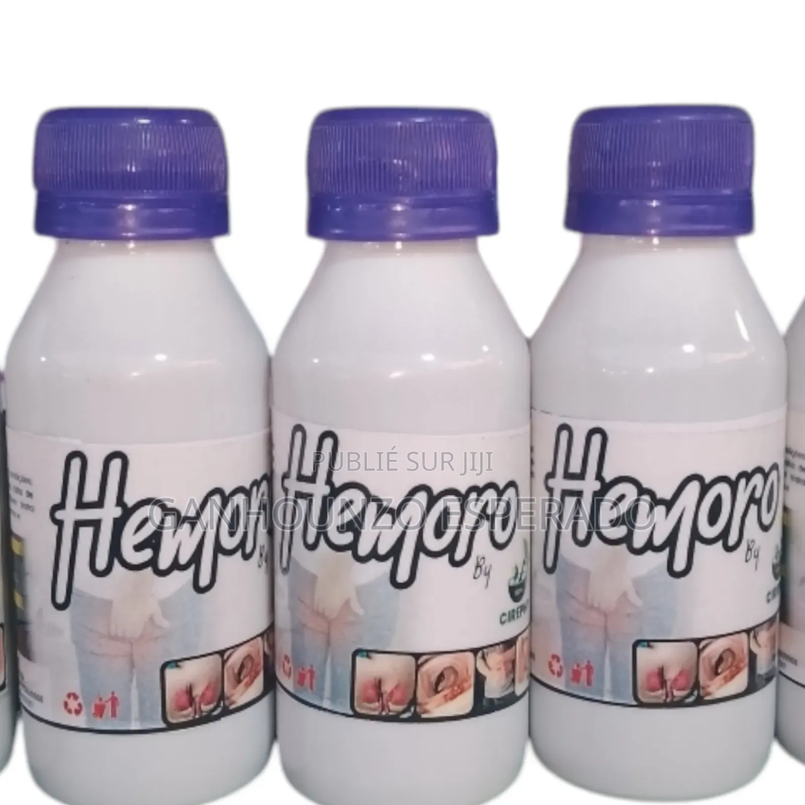 Finir Avec Hémorroïdes Internes Où Estern Dans 2 Semaine