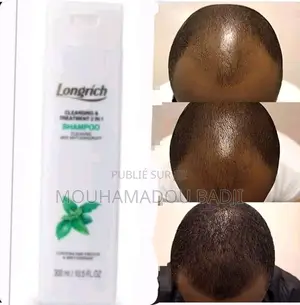 Championg Très Efficace Pour Les Cheveux