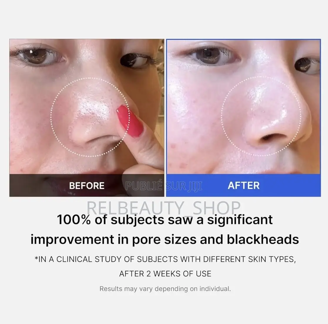 Medicube Zero Pad 2.0