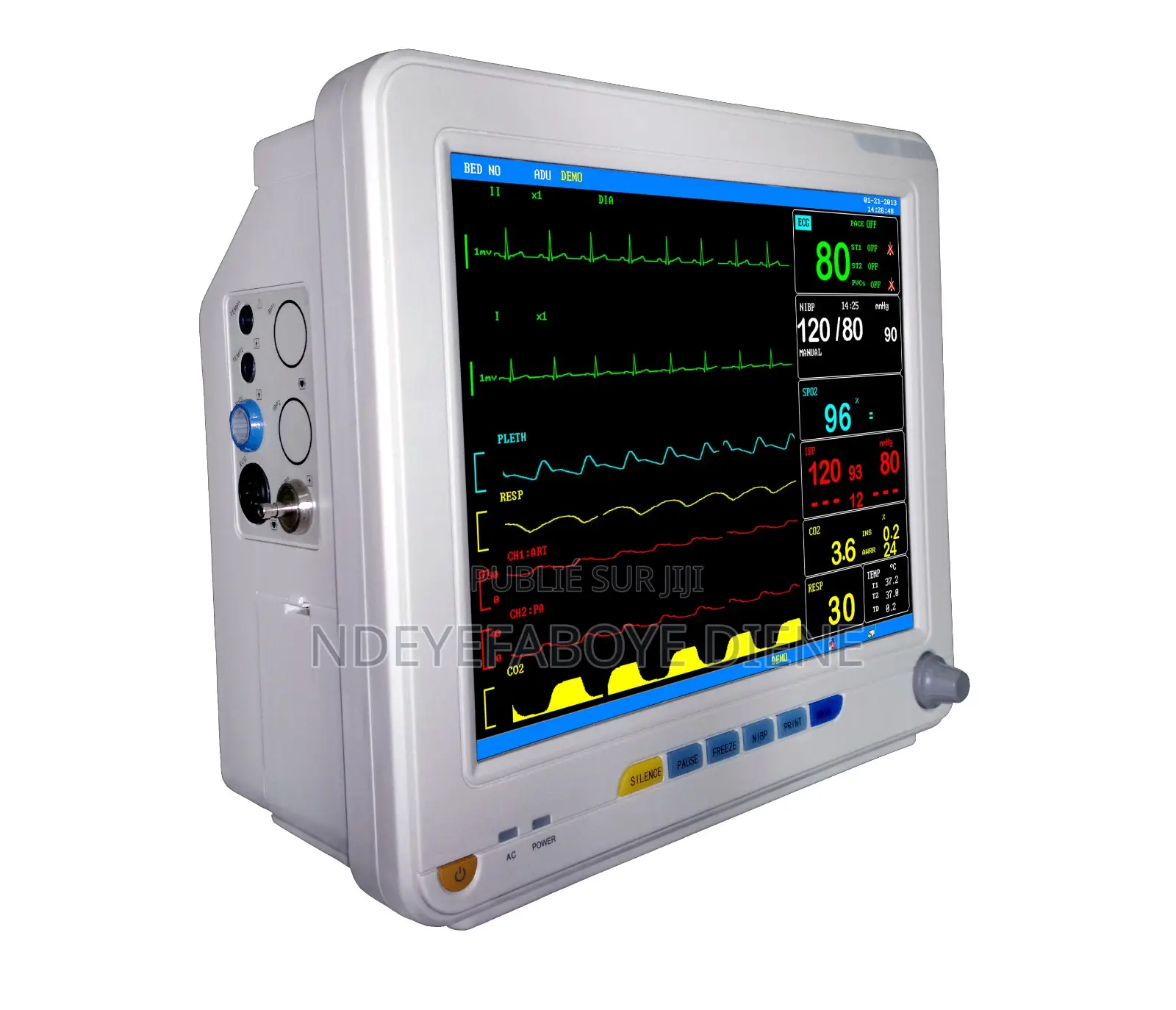 Moniteur De Surveillance Multi Paramétriques