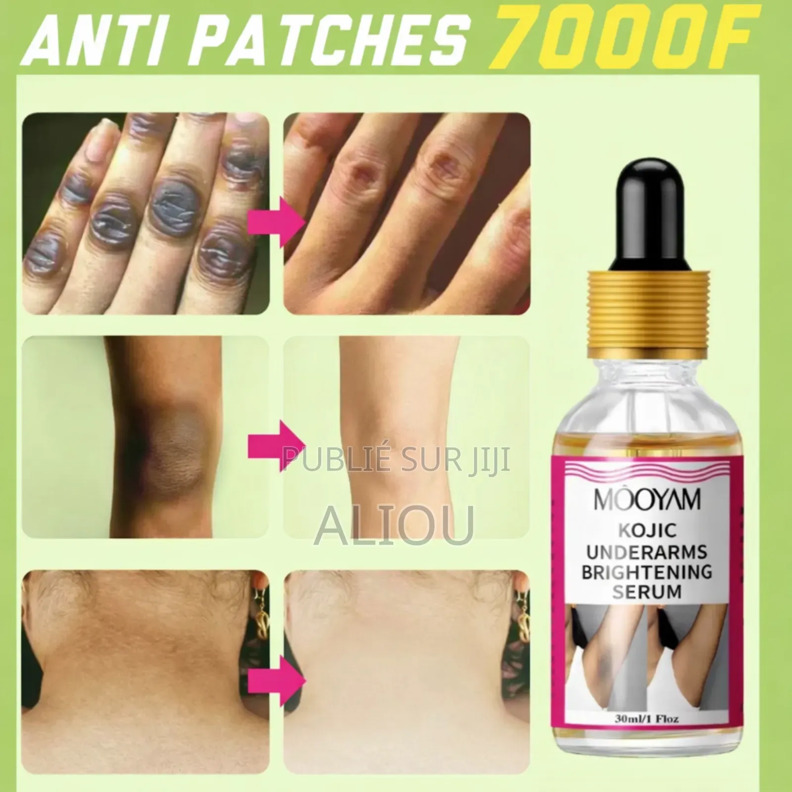Anti Patches