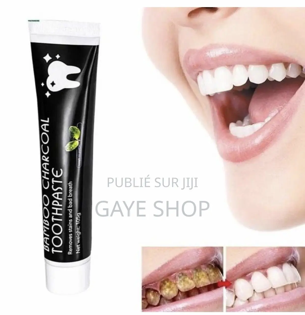 Pâte Dentifrice Charbon Blanchissante De Dents
