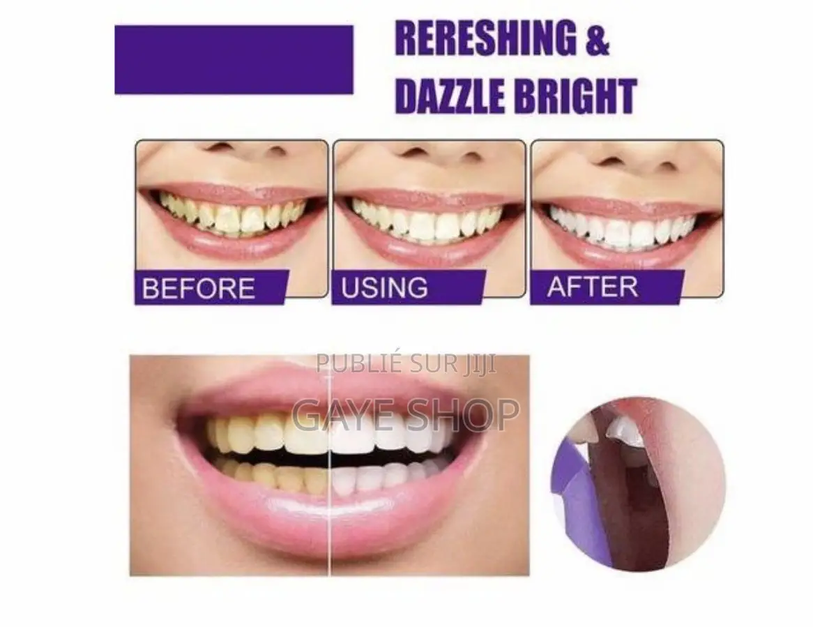 Mousse V34 Dentifrice Soin Dentaire