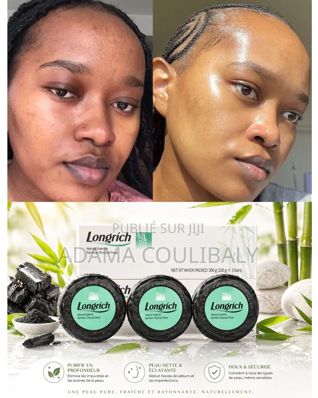 Savon Au Charbon De Bambou Longrich – Peau Nette Éclatante !
