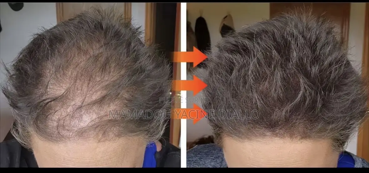 Box Fibre Capillaire + Spray Fixateur
