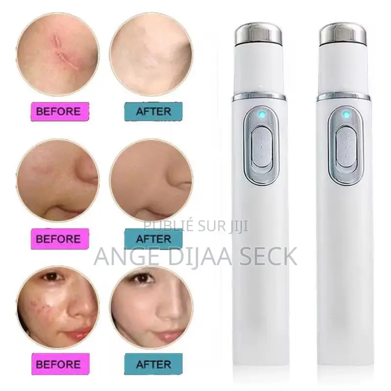 Stylo Laser