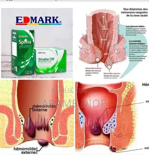 Produits Edmark Et Bijoux