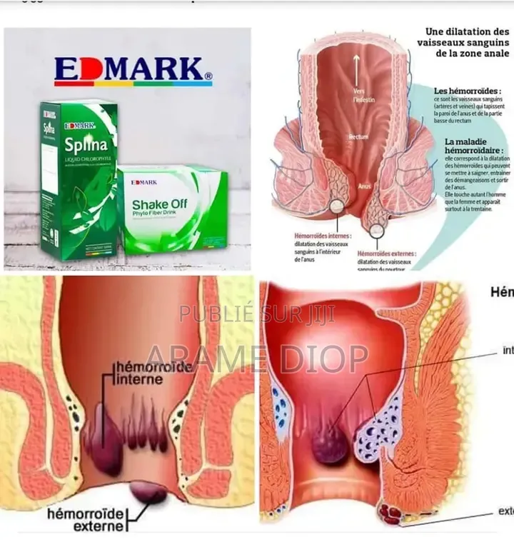 Produits Edmark Et Bijoux