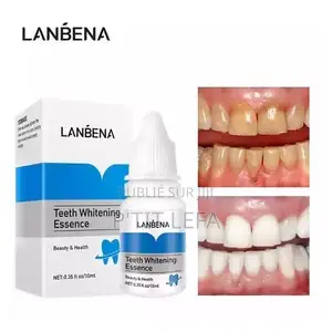 Lanbena Teeth Whitening Essence – Sérum Blanchissant Pour Dents