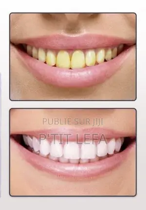 Lanbena Teeth Whitening Essence – Sérum Blanchissant Pour Dents