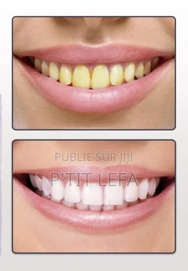 Lanbena Teeth Whitening Essence – Sérum Blanchissant Pour Dents