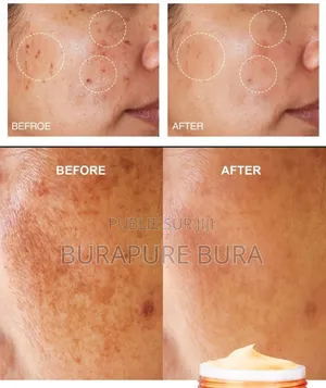 Crème Visage Balea À La Vitamine C SPF 15, 50 Ml