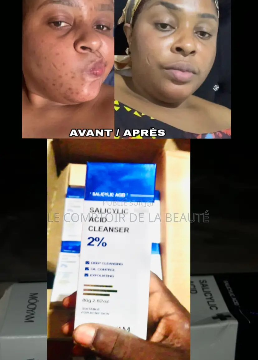  Annonce Flash : Teint Net Zéro Brillance 