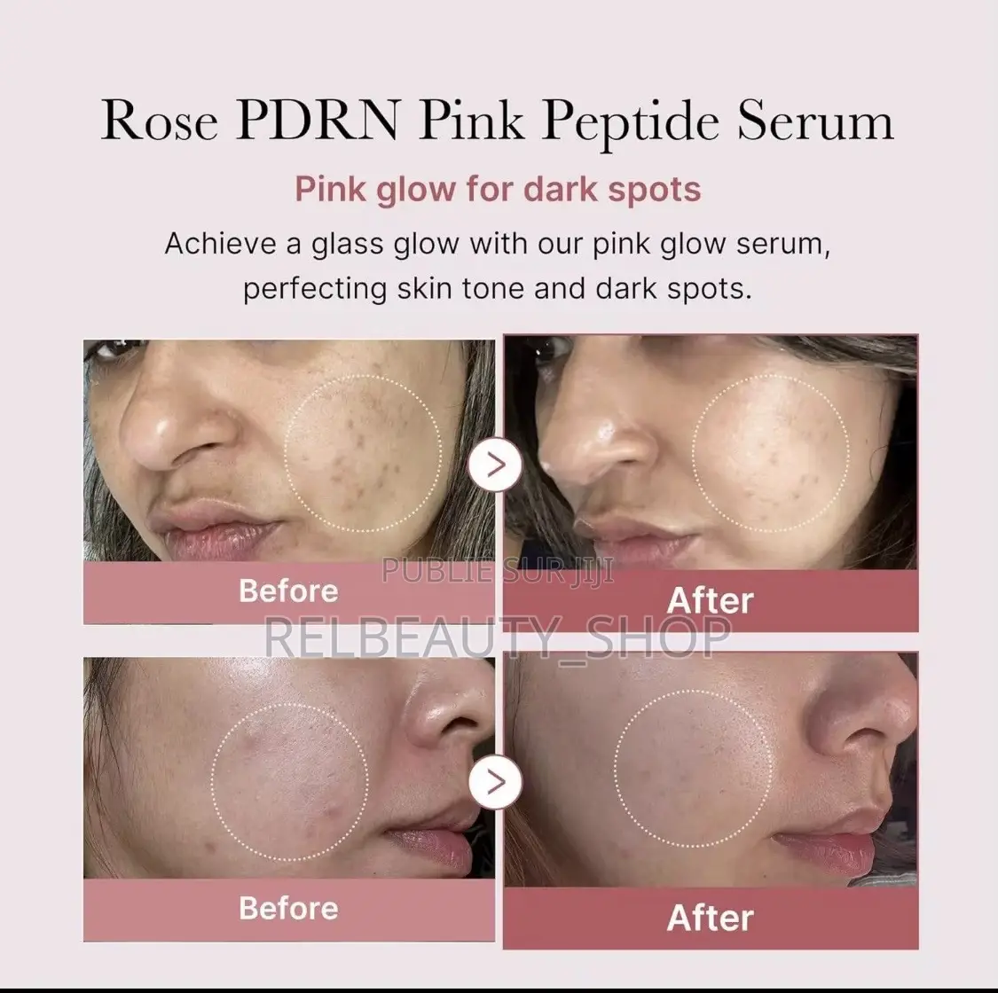 Medicube Serum Peptide Rose PDRN