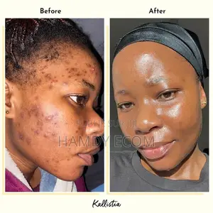 Réveille-toi Avec Une Peau Transformée. Littéralement.