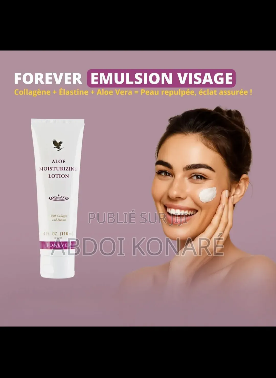Émission Vissage Collagène