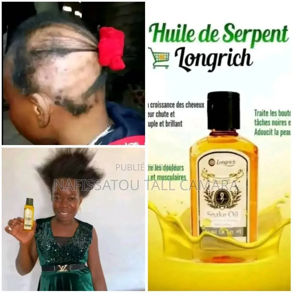 Huile De Serpent