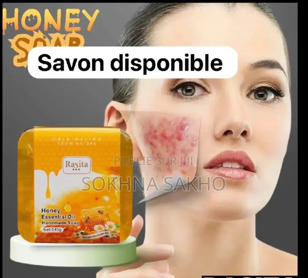 Savon Du Visage Pour Peau Grasse