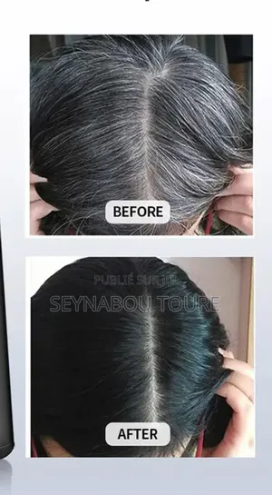 Vente De Champoing Pour Rendre Les Cheuveux Noirs