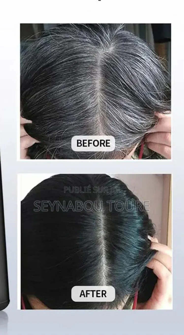 Vente De Champoing Pour Rendre Les Cheuveux Noirs