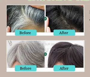 Vente De Champoing Pour Rendre Les Cheuveux Noirs