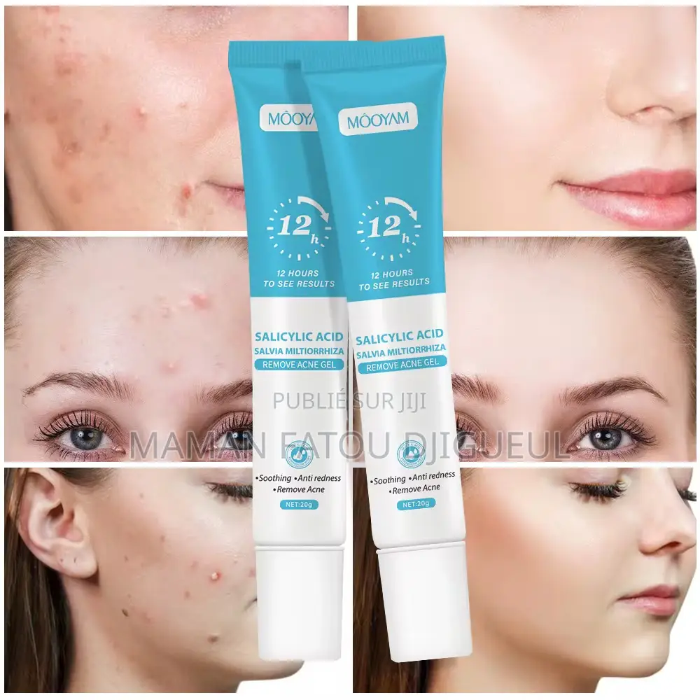 Mooyam Gel Anti-Acné À L’Acide Salicylique 30g – Anti Boutons